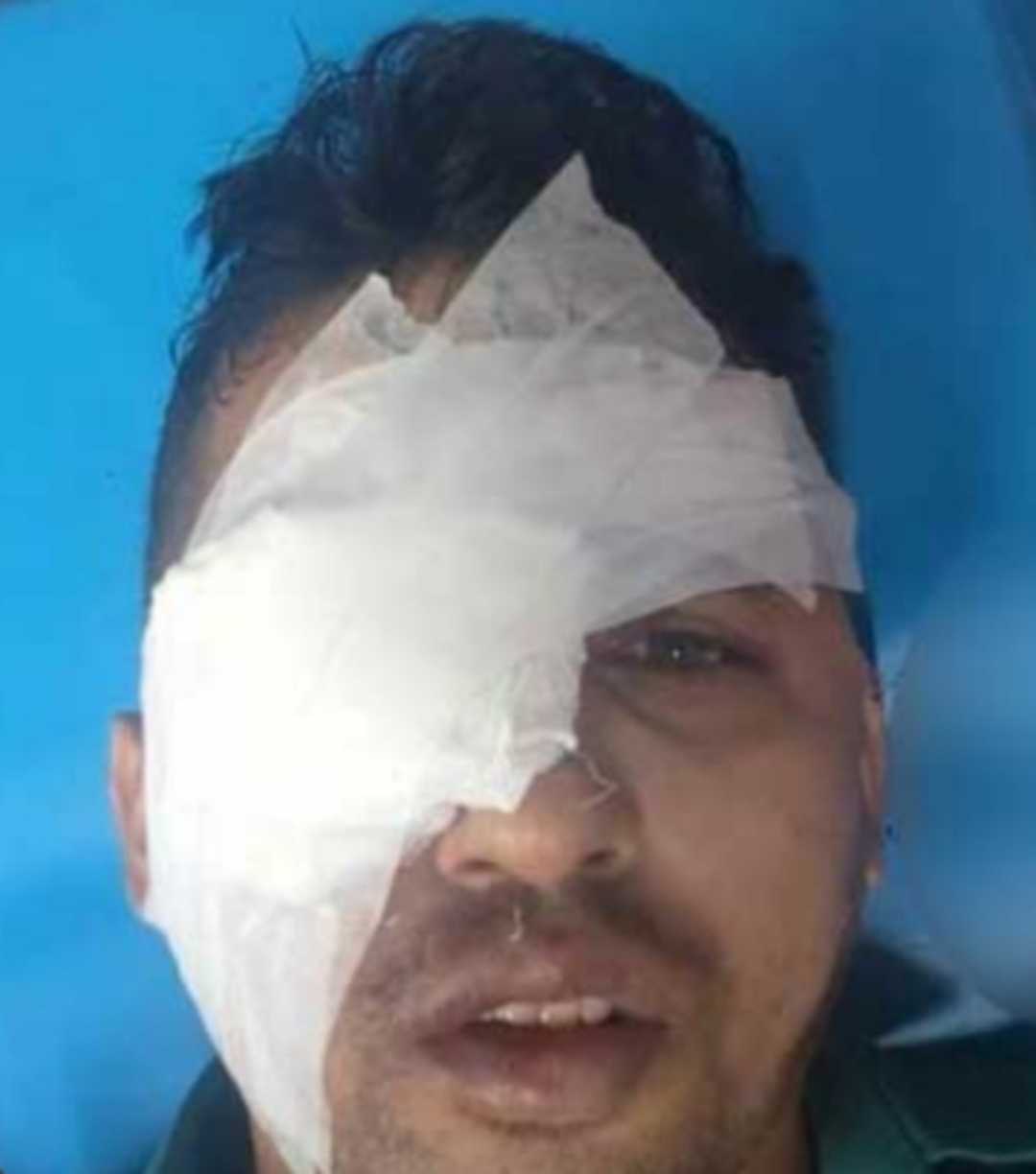 ছিনতাইকারী হিজড়াদের হামলায় চোখ হারালেন এস,আই মোঃ মোজাহিদ